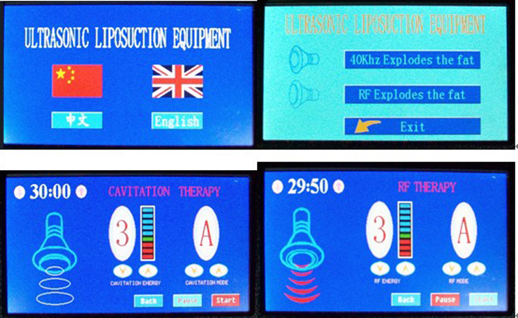 DWJK-702 - Ultrasonic Liposuction Equipment Cavitation Slimming - mychway DWJK-702 - Ultrasonic Liposuction Equipment Cavitation Slimming - mychway