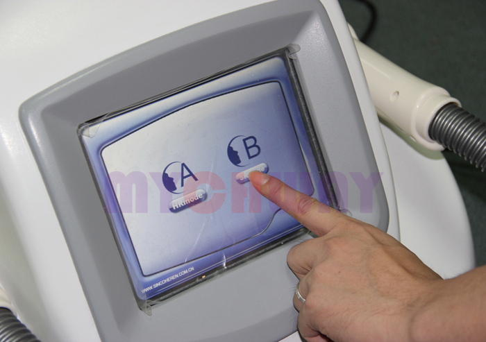 HR-NK - Ipl Hair  Removal Acne Speckle Age Spot Freckle Removal - mychway