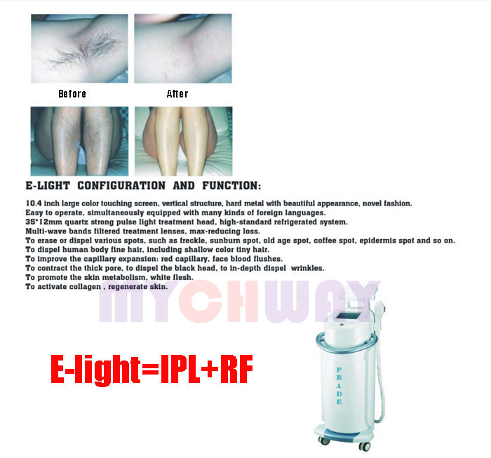 LT-580E - E-light Ipl Hair Removal Rf Skin Rejuvenation Facial - mychway