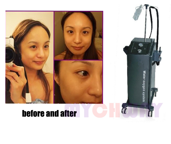 SR-H200 - Water Oxygen Jet Peel Oxygen Injection Beauty Equipment - mychway