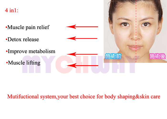 SR-MID5 - Intense Pulsed Light Microcurrent Tens Cavitation Lift - mychway