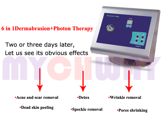 SR-MID7 - Diamond Dermabrasion Microdermabrasion Scrubber Machine - mychway SR-MID7 - Diamond Dermabrasion Microdermabrasion Scrubber Machine - mychway