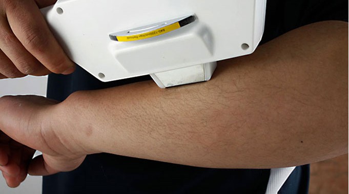 SR801B - Ipl Hair Removal Skin Rejuvenation Equipment Portable - mychway SR801B - Ipl Hair Removal Skin Rejuvenation Equipment Portable - mychway