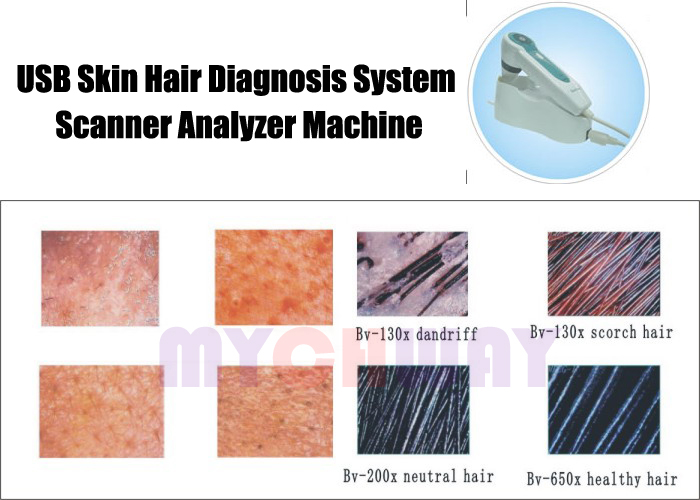 TS-6100U - Usb Skin Hair Diagnosis System Scanner Analyzer Machine - mychway