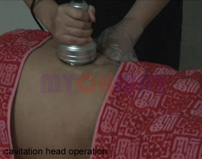 WL-RU2 - Ultrasonic Liposuction Cavitation Tripolar Bipolar - mychway